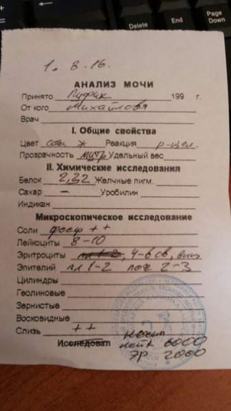 моча 01.08.2016.jpg